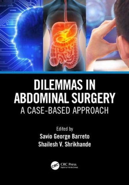 Book cover of: Dilemmas in Abdominal Surgery. By: Savio George Barreto