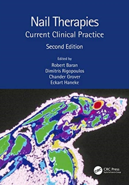 Book cover of: Nail Therapies. By: R. Baran