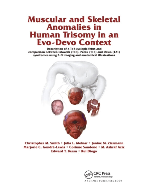 Book cover of: Muscular and Skeletal Anomalies in Human Trisomy in an Evo-Devo Context. By: Rui Diogo