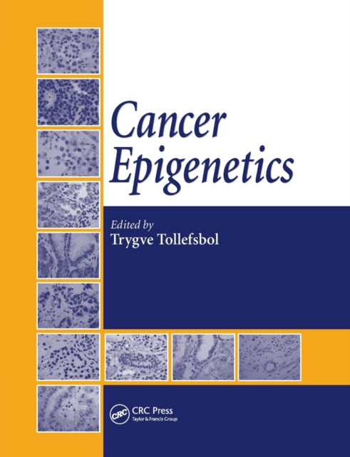 Book cover of: Cancer Epigenetics. By: Trygve O. Tollefsbol
