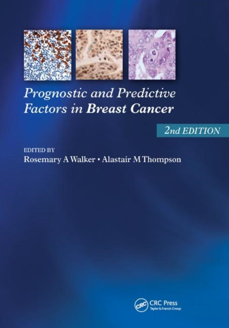 Book cover of: Prognostic and Predictive Factors in Breast Cancer. By: Rosemary A. Walker