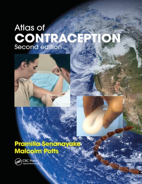 Book cover of: Atlas of Contraception. By: Pramilla Senanayake
