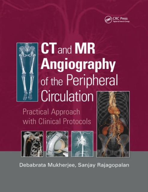 Book cover of: CT and MR Angiography of the Peripheral Circulation. By: Debabrata Mukherjee