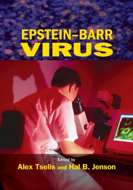 Book cover of: Epstein-Barr Virus. By: Alex Tselis