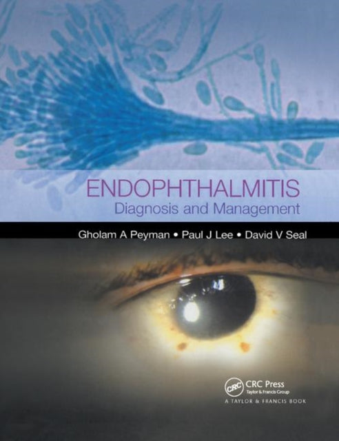Book cover of: Endophthalmitis. By: Paul J. Lee