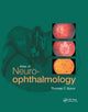 Book cover of: Atlas of Neuro-ophthalmology. By: Thomas C. Spoor