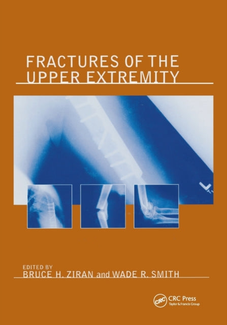 Book cover of: Fractures of the Upper Extremity. By: Bruce H. Ziran