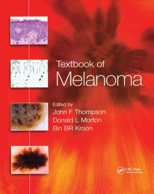 Book cover of: Textbook of Melanoma. By: John F. Thompson