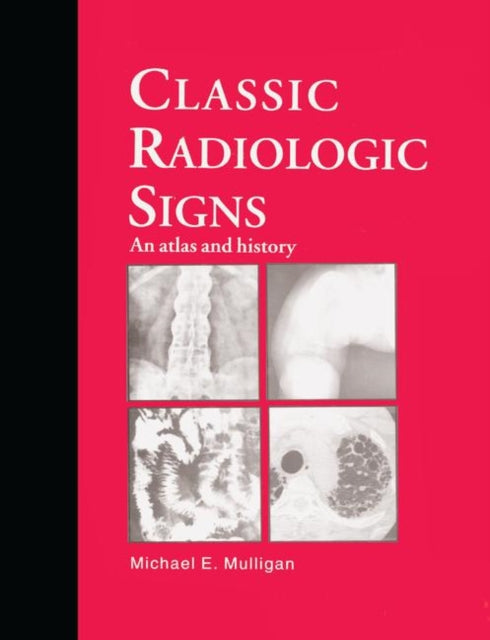 Book cover of: Classic Radiologic Signs. By: M. E. Mulligan