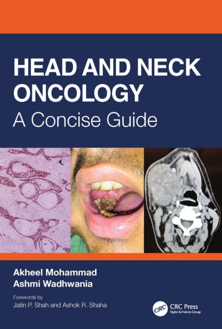 Book cover of: Head and Neck Oncology. By: Mohammad Akheel