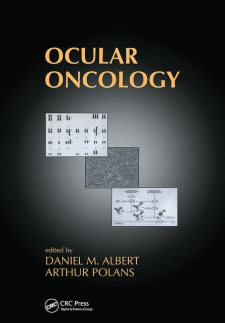 Book cover of: Ocular Oncology. By: Daniel M. Albert