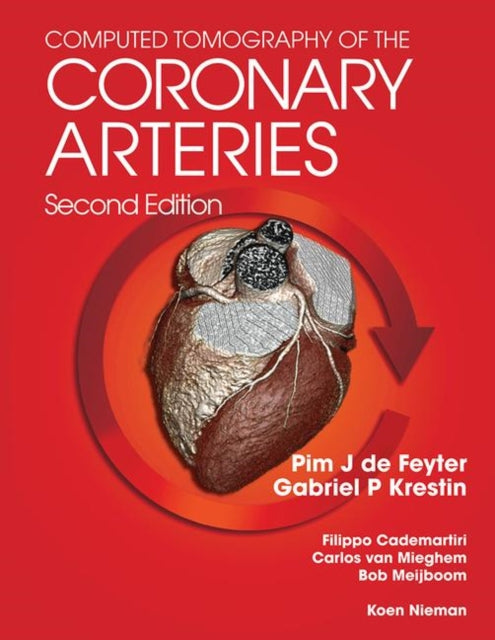 Book cover of: Computed Tomography of the Coronary Arteries