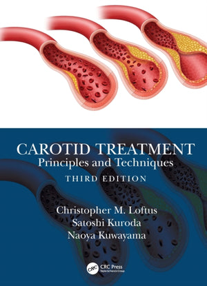 Carotid Treatment: Principles and Techniques