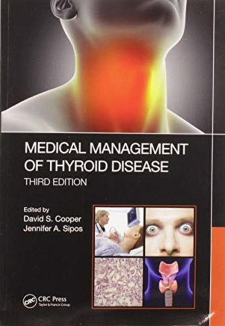 Book cover of: Medical Management of Thyroid Disease, Third Edition. By: David S. Cooper
