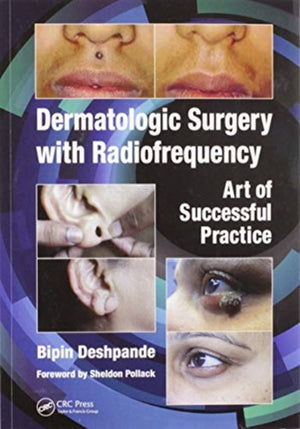 Dermatologic Surgery with Radiofrequency