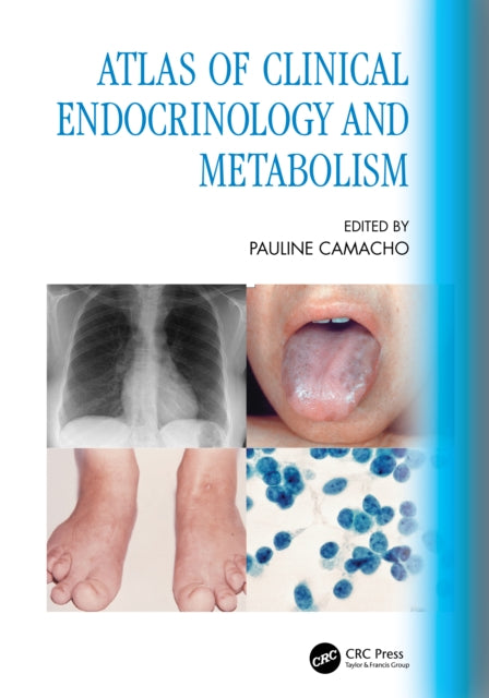 Book cover of: Atlas of Clinical Endocrinology and Metabolism. By: Pauline Camacho
