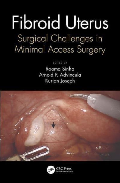 Book cover of: Fibroid Uterus. By: Rooma Sinha
