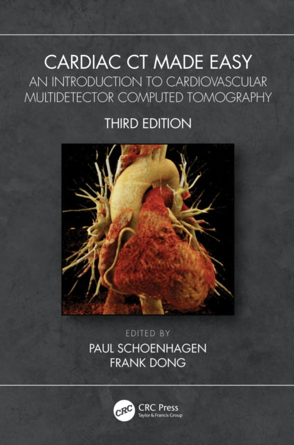 Book cover of: Cardiac CT Made Easy. By: Paul Schoenhagen