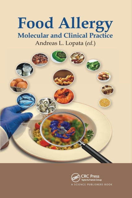 Book cover of: Food Allergy. By: Andreas Ludwig Lopata