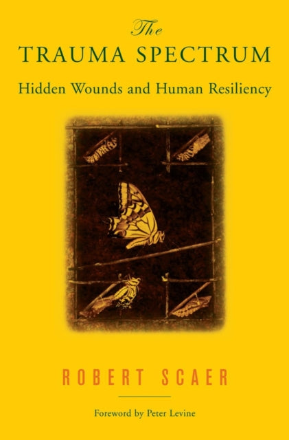 Book cover of: Trauma Spectrum. By: Robert C. Scaer