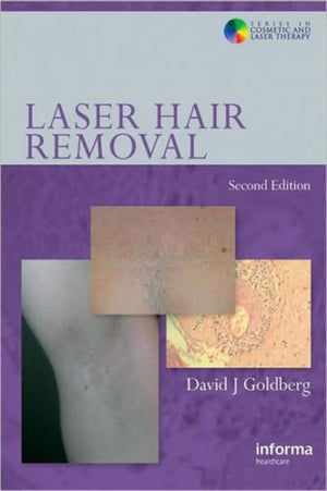 Laser Hair Removal