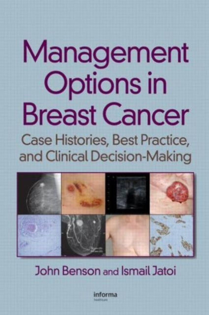 Book cover of: Management Options in Breast Cancer