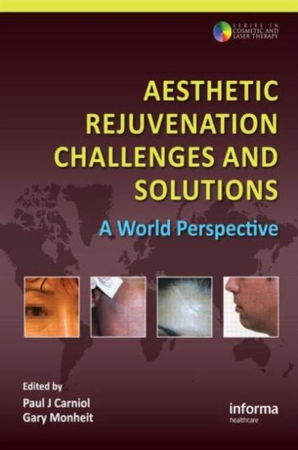 Book cover of: Aesthetic Rejuvenation Challenges and Solutions. By: Paul J. Carniol