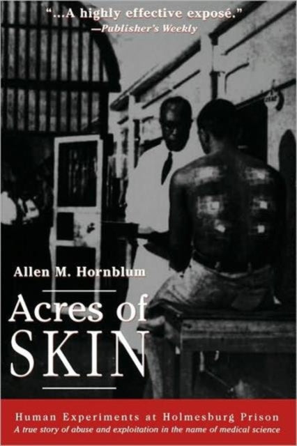 Book cover of: Acres of Skin. By: Allen Hornblum
