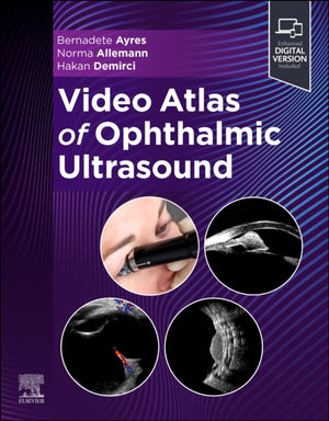 Video Atlas of Ophthalmic Ultrasound