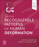 Book cover of: Smith's Recognizable Patterns of Human Deformation. By: John M. Graham