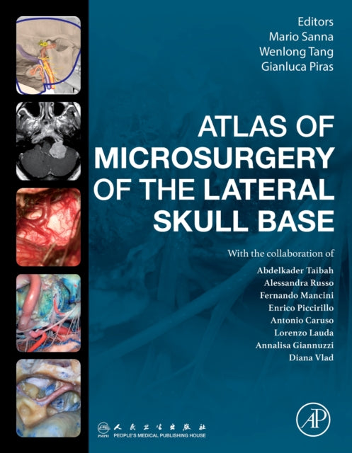 Book cover of: Atlas of Microsurgery of the Lateral Skull Base. By: Mario Sanna