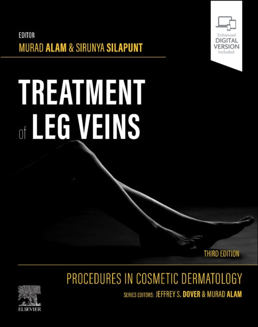 Book cover of: Procedures in Cosmetic Dermatology Series: Treatment of Leg Veins