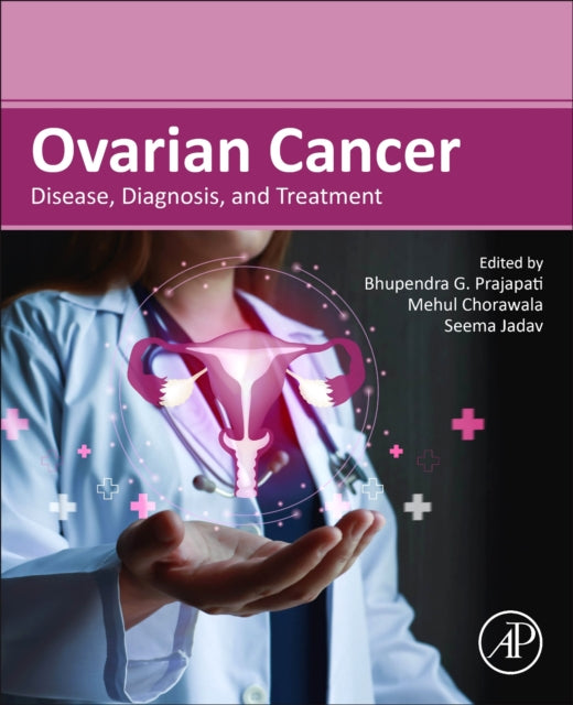 Book cover of: Ovarian Cancer