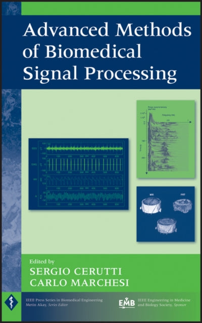 Book cover of: Advanced Methods of Biomedical Signal Processing. By: Sergio Cerutti