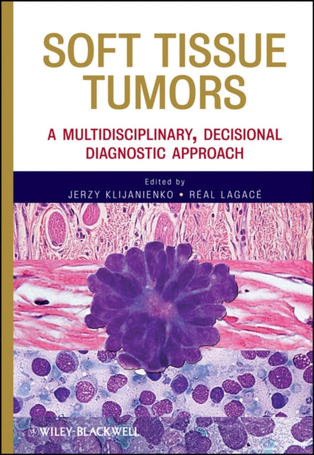 Book cover of: Soft Tissue Tumors. By: Jerzy Klijanienko