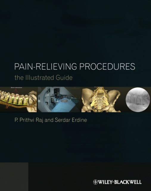 Book cover of: Pain-Relieving Procedures. By: P. Prithvi Raj