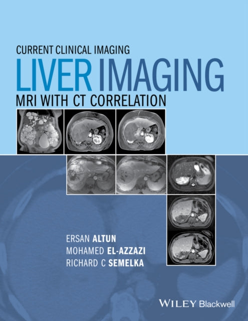 Book cover of: Liver Imaging. By: Mohamed El-Azzazi