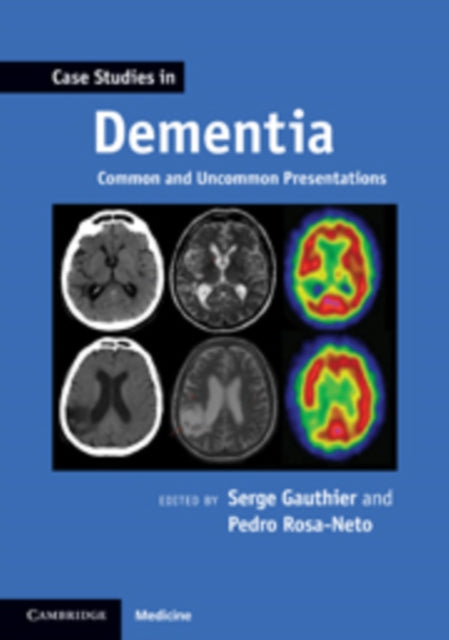 Book cover of: Case Studies in Dementia: Volume 1. By: Serge Gauthier