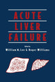 Book cover of: Acute Liver Failure
