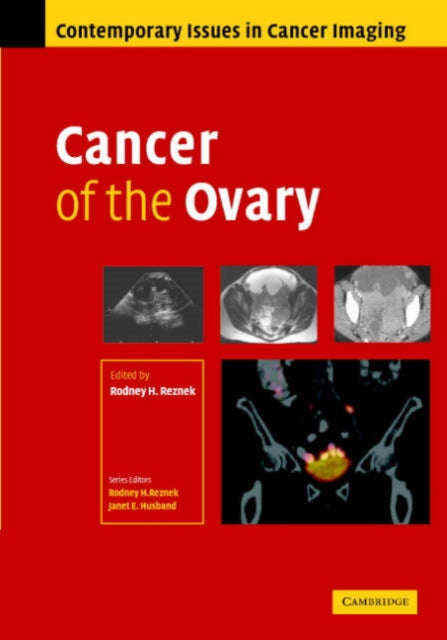Book cover of: Cancer of the Ovary. By: Rodney Reznek