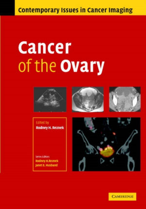 Cancer of the Ovary