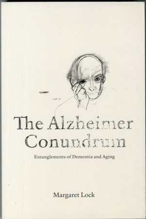 Alzheimer Conundrum