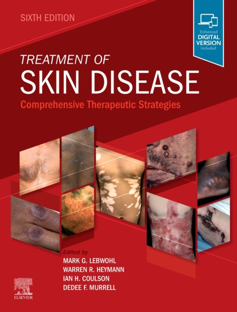 Book cover of: Treatment of Skin Disease. By: Mark G. Lebwohl M.D.  Ph.D.