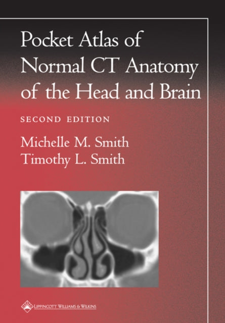 Book cover of: Pocket Atlas of Normal CT Anatomy of the Head and Brain. By: Michelle M Smith