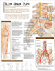Book cover of: Understanding Low Back Pain Anatomical Chart
