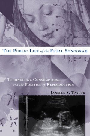 Public Life of the Fetal Sonogram