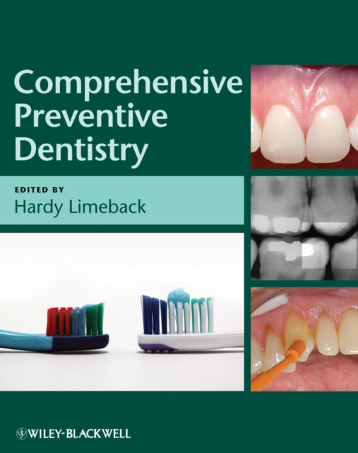 Book cover of: Comprehensive Preventive Dentistry. By: Hardy Limeback