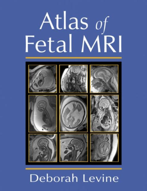 Book cover of: Atlas of Fetal MRI. By: Deborah Levine