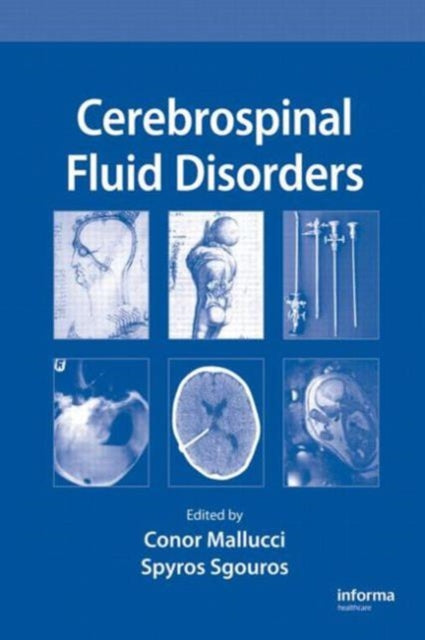 Book cover of: Cerebrospinal Fluid Disorders