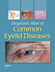 Book cover of: Diagnostic Atlas of Common Eyelid Diseases. By: Jonathan J. Dutton